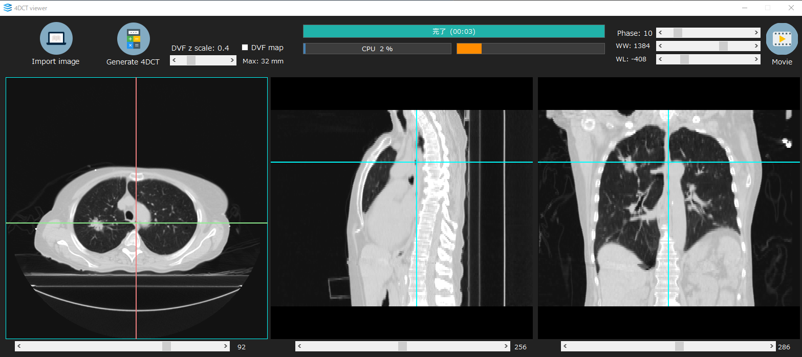 Screen of the bundled simple viewer (4DCT viewer)